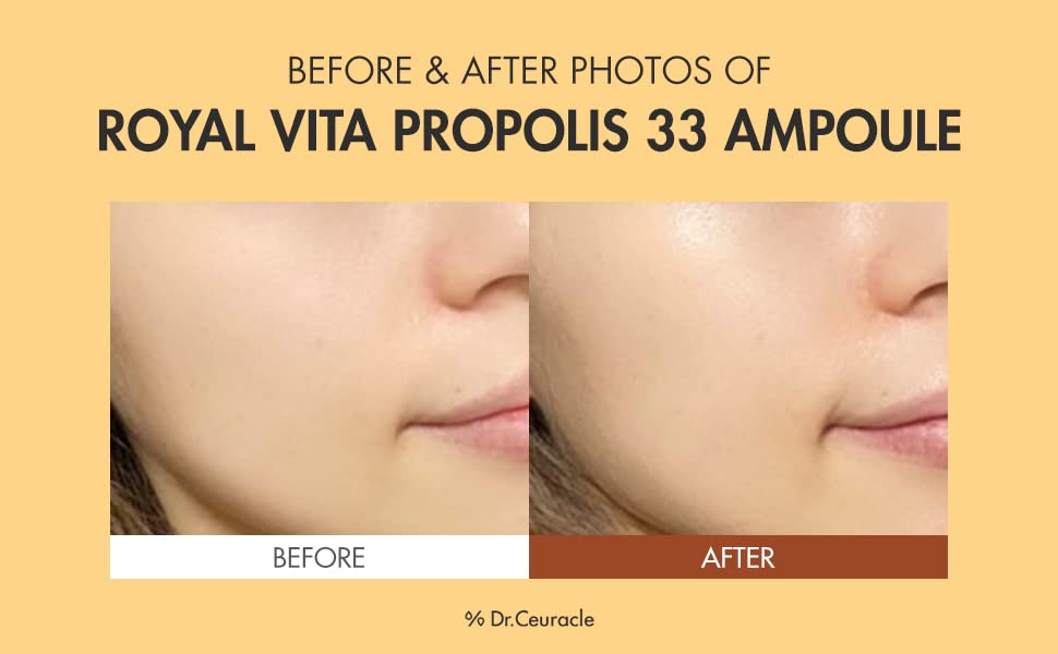 Dr. Ceuracle - Royal Vita Propolis 33 Ampoule Jumbo