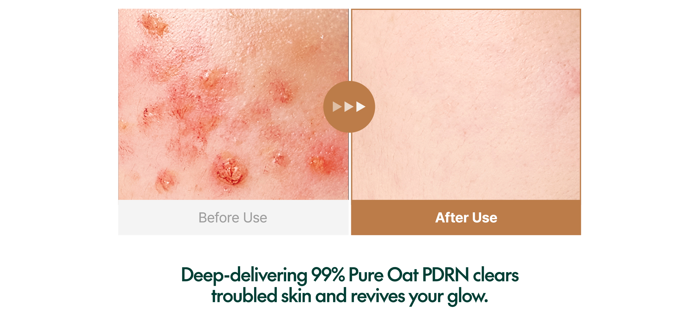 Purito SEOUL - Oat PDRN Gentle Refining Toner