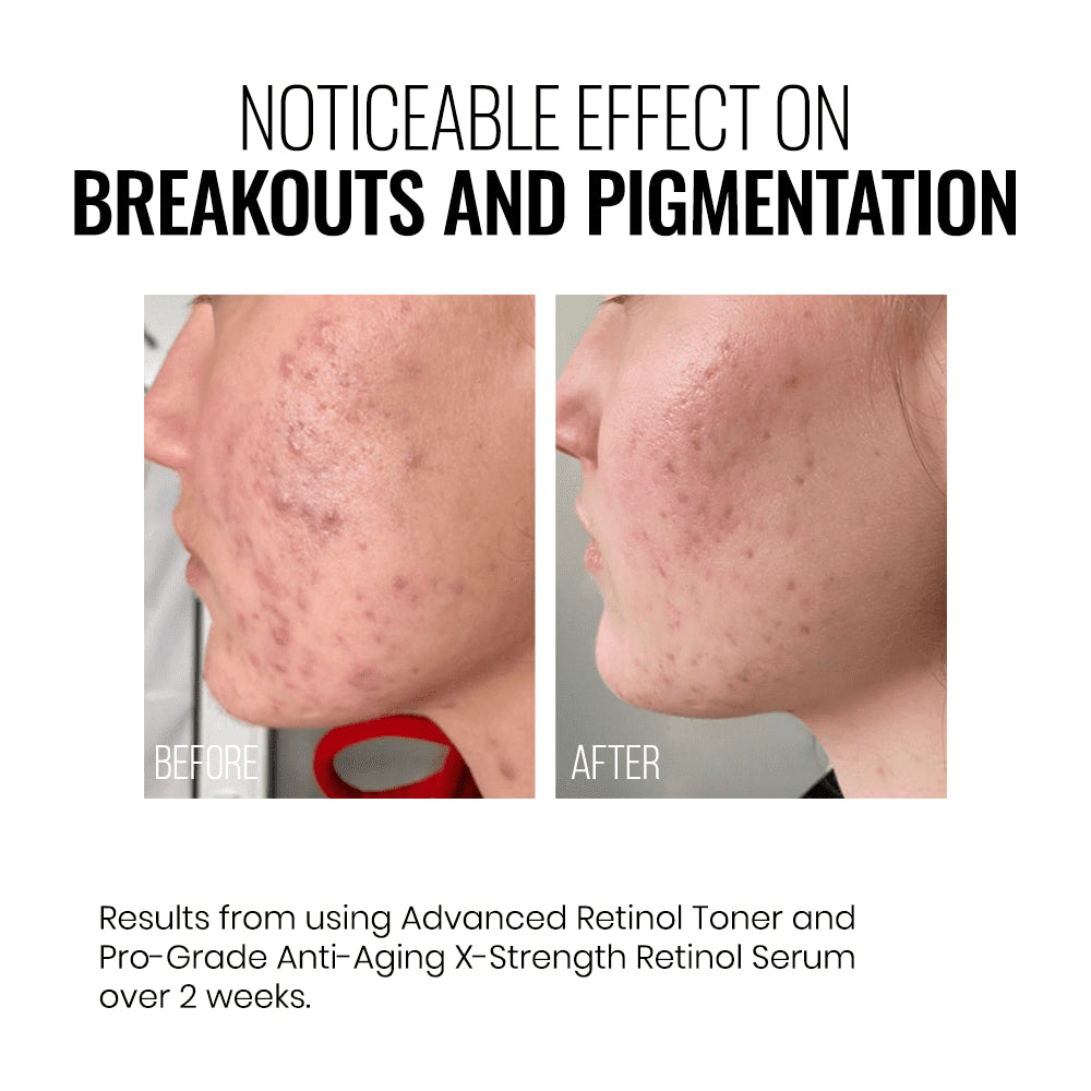 INSTYTUTUM X-STRENGTH RETINOL SERUM