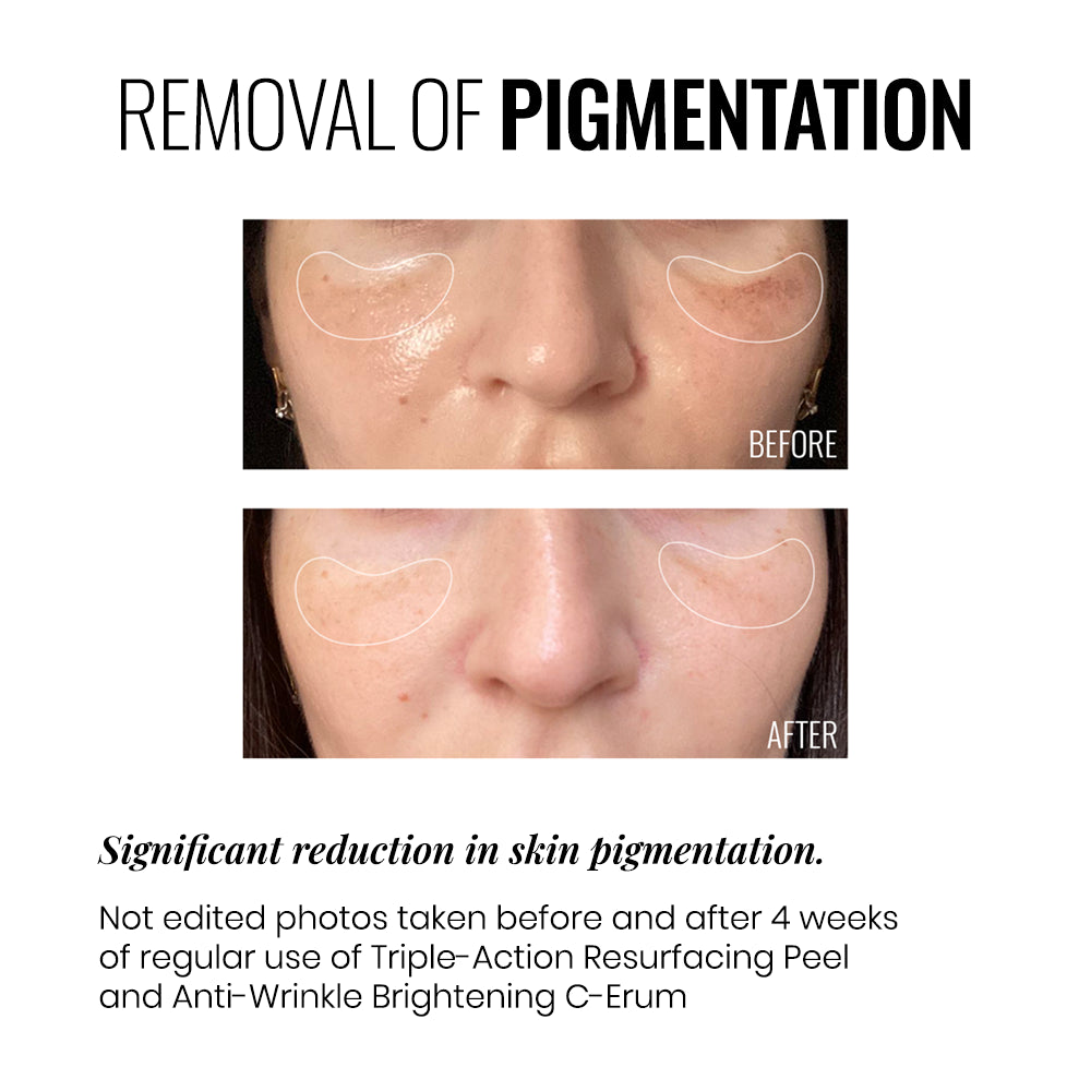 TRIPLE-ACTION RESURFACING PEEL